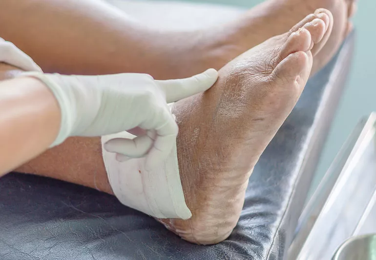 शरीर में यूरिक एसिड बढ़ने से हो सकती है गंभीर बीमारियां, इन लक्षणों को न करे अनदेखा