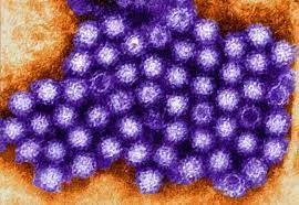 What is noravirus in Hindi